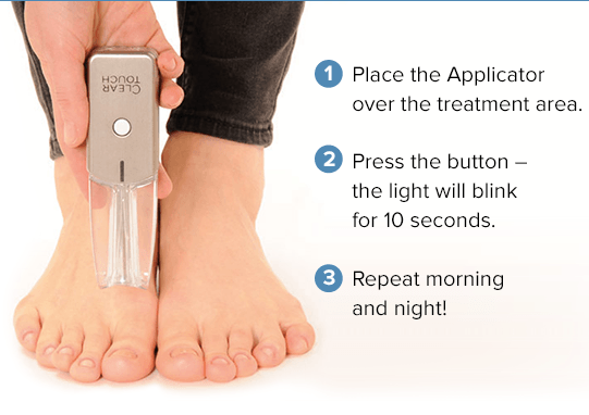 ClearTouch at Home Phototherapy Treatment for ToeNail Fungus - Brand New in Box