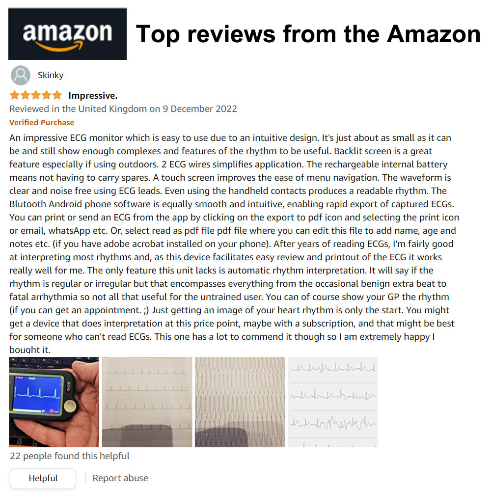 Touch Screen EKG Monitor Heart Monitor with ECG Cable AI-ECG Analysis via App