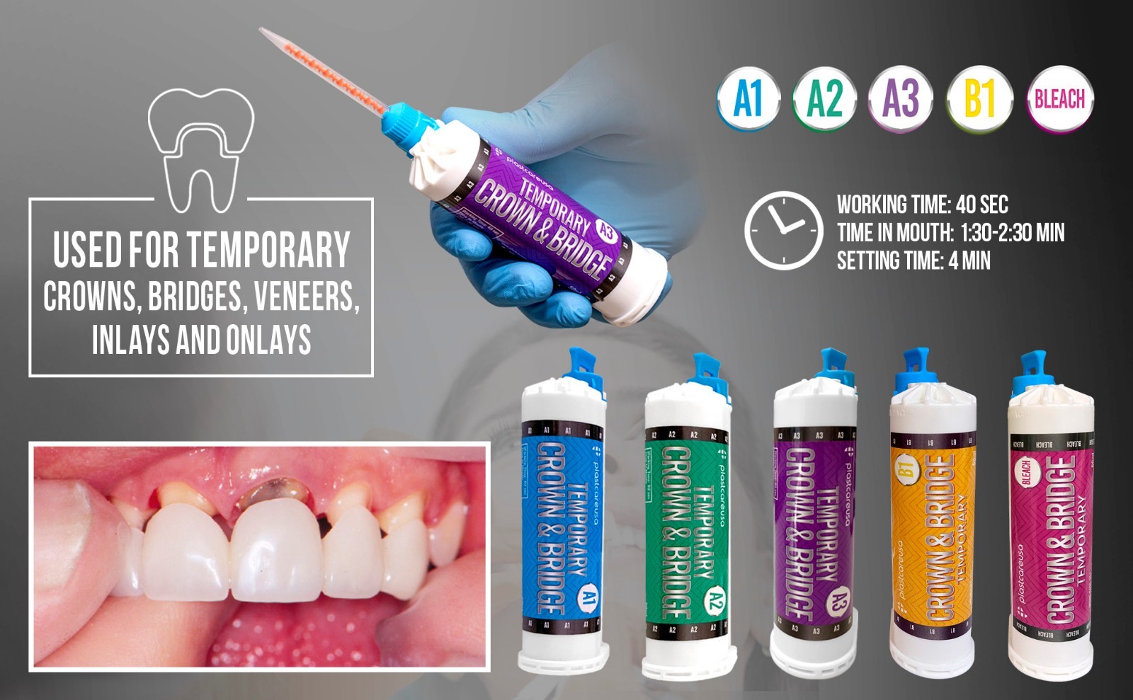 Dental A2 Temporary Crown & Bridge Material (10:1) + Includes 5 Mixing Tips