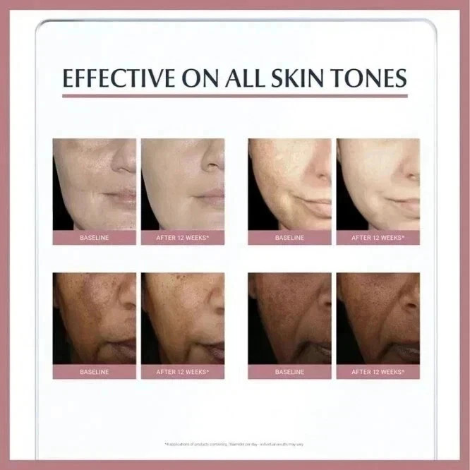 Eucerin Anti-Pigment Dual Face Serum for Pigmentation & Dark Spots 30ml