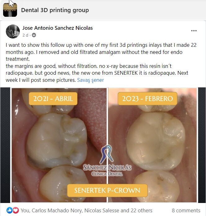 DLP SLA LCD 3d printer permenant crown - teeth resin ..