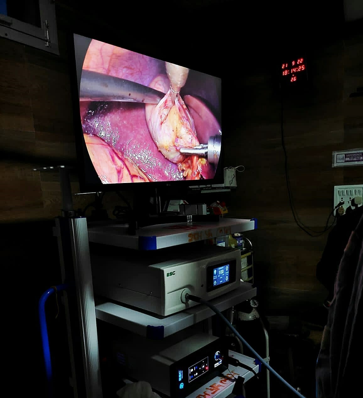 Full HD Endoscopy Laparoscopic Camera for Storz Stryker Medical Rigid Endoscope