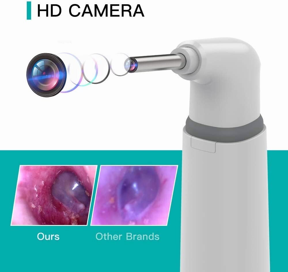 Wireless Otoscope Ear Camera with Dual View, 3.9Mm 720PHD Wifi Ear Scope 6 LED