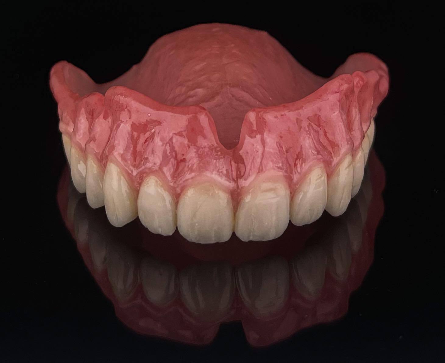 DLP SLA LCD 3d printer ALL ON X resin - for all on x cases, bridges,arcs, hybrid