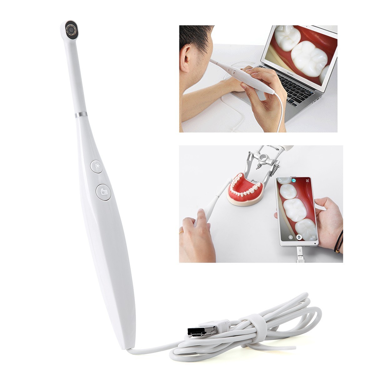 8LED Light Dental USB Imaging Intraoral Camera Real-time Video Oral Endoscope