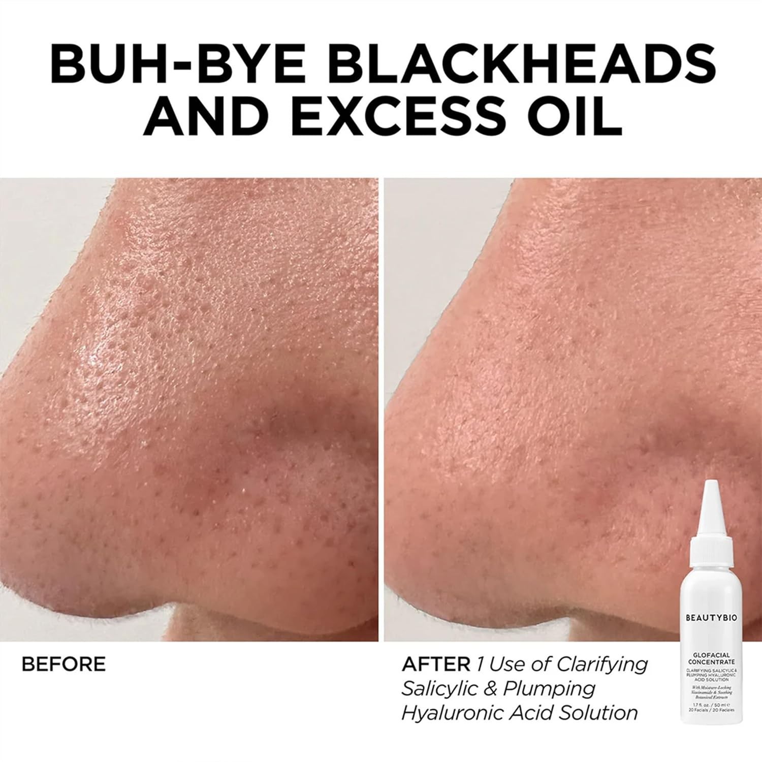 BeautyBio GLOfacial Hydro-Infusion Deep Pore Cleansing With Blue LED - Green -