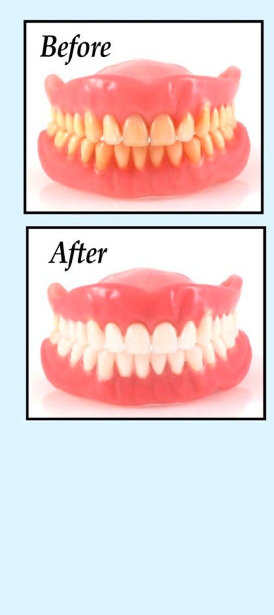 Sparkle-Dent Denture Whitener and Cleaner