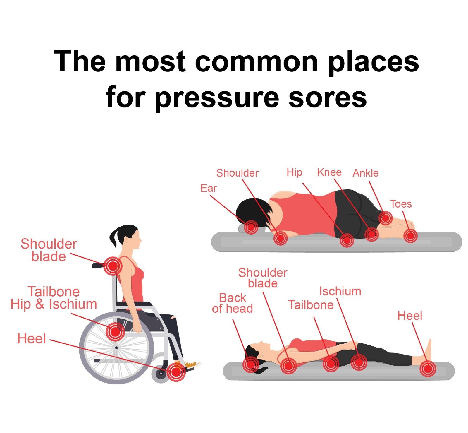 TriDerma Pressure Sore Relief Healing Cream for Bed Sores Treatment, Ulcers 4 oz