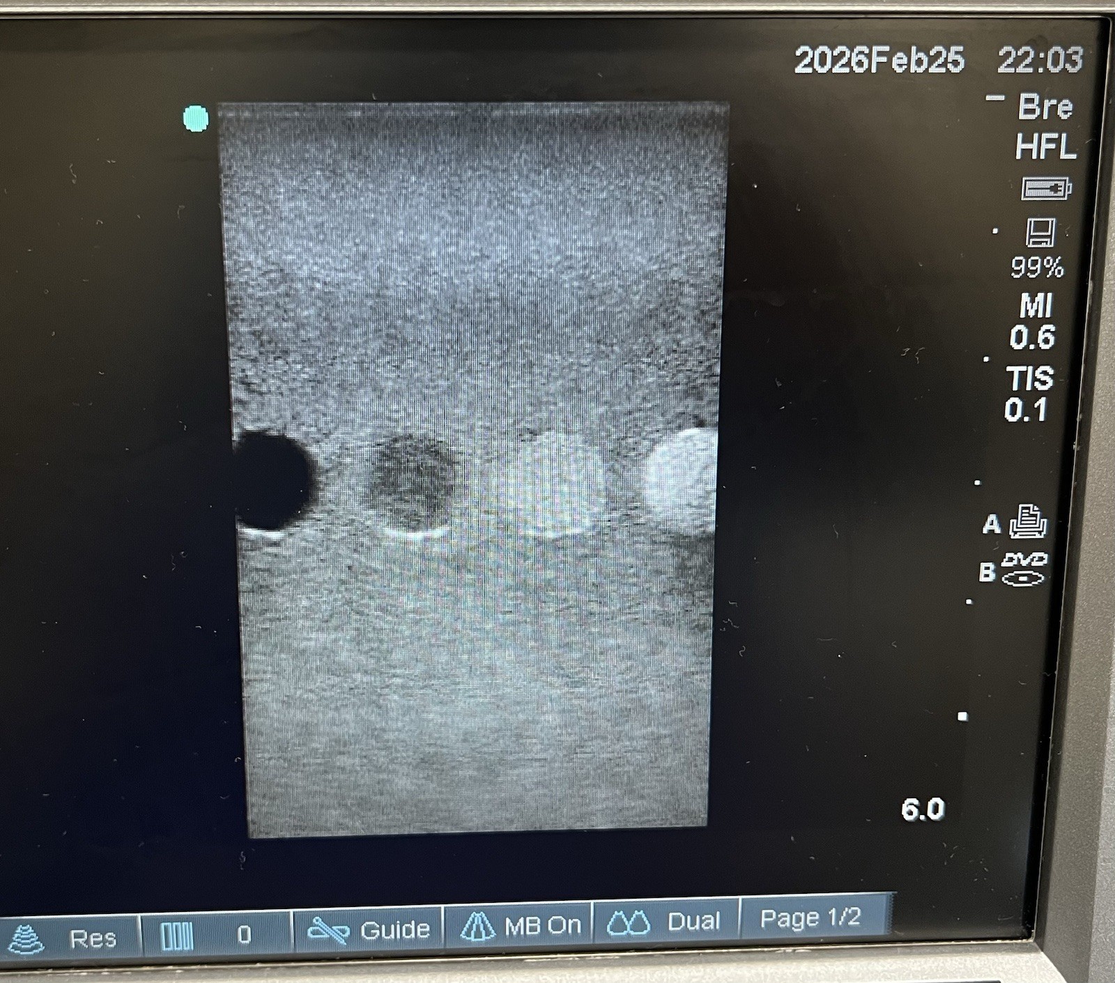 Sonosite HFL38X/13-6 MHz Ref P07682-70 (Parts Only)