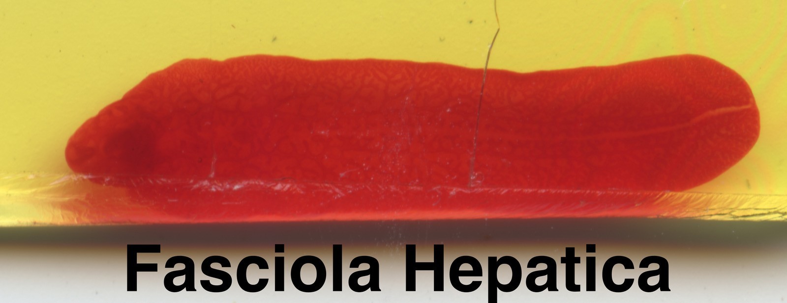 Parasite Microscope Slide Set Deadly Disease Insect Whole Mount Helminth Worm