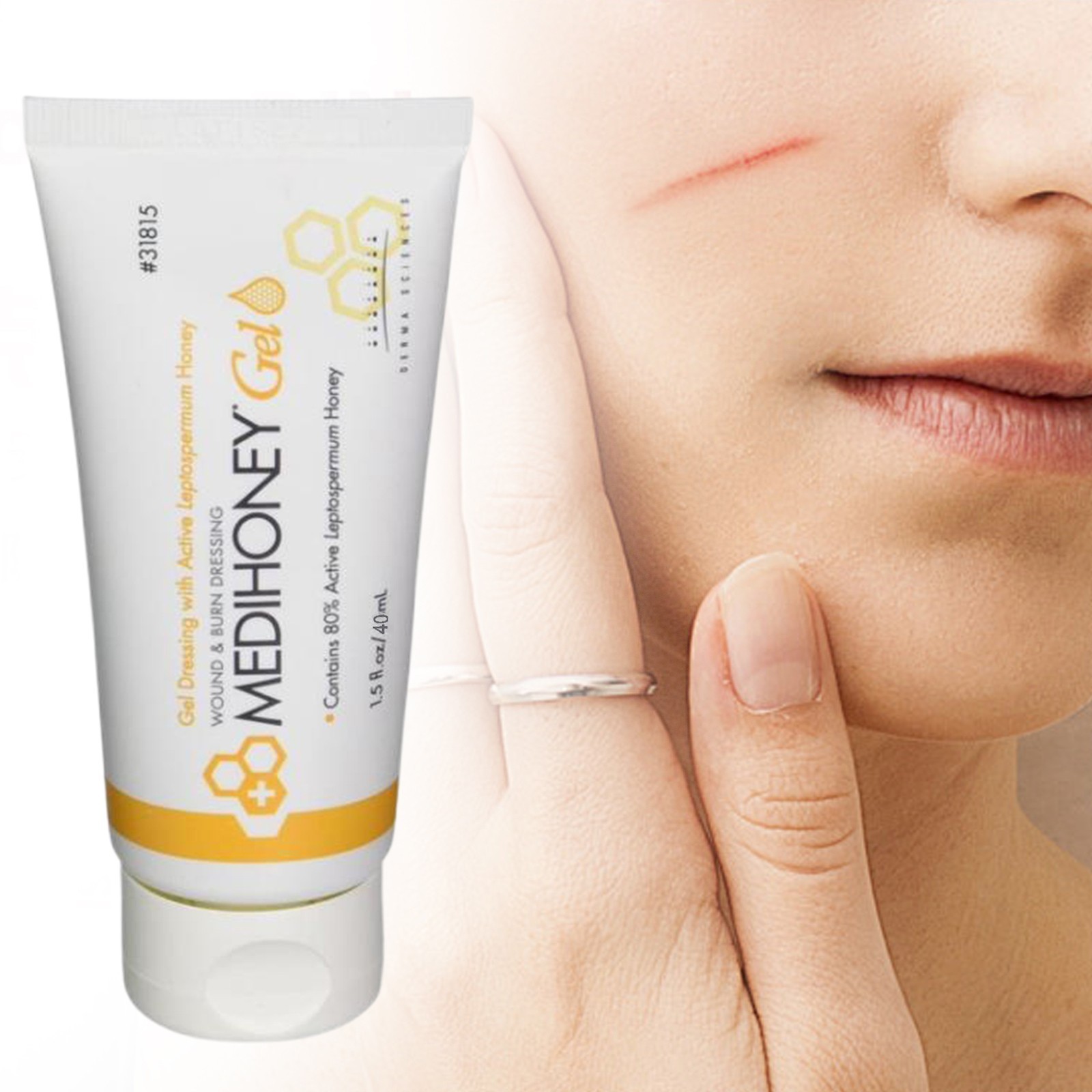 MediHoney - 1.5 oz Gel Wound & Burn Dressing Tube Medical Grade Honey