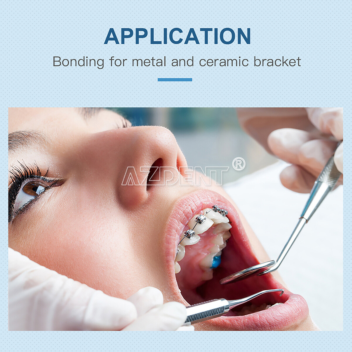 Sistema de pegado de resina de ortodoncia dental para curar los brackets