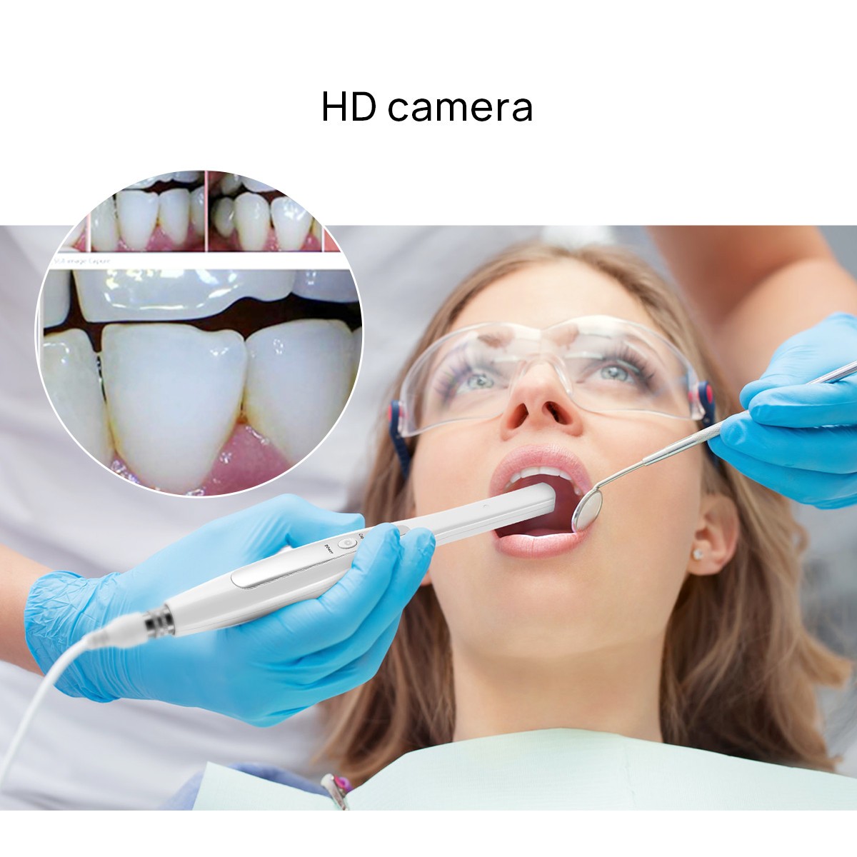 AZDENT Dental HD USB Intraoral Camera Imaging Intra Oral Endoscope 8/6 LED