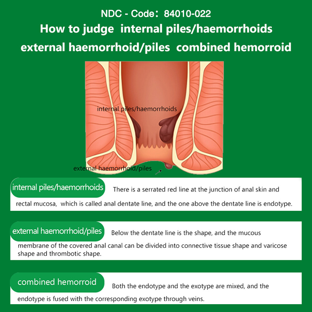 Hemorrhoid Cream, Hemorrhoid Treatment, Hemorrhoid & Fissure Ointment, Fast