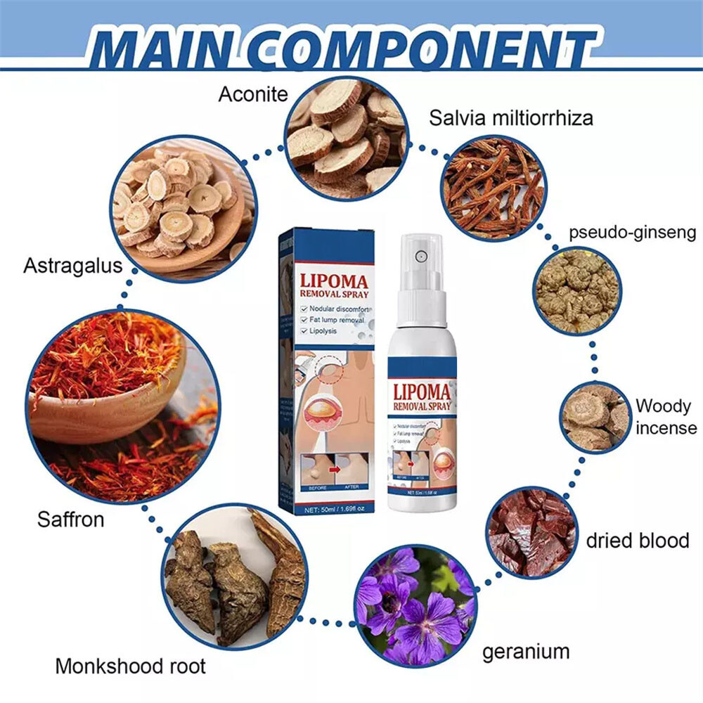 50ML Lipomheilung Reduction Spray, Instant LumpFree Lipoma Removal Spray