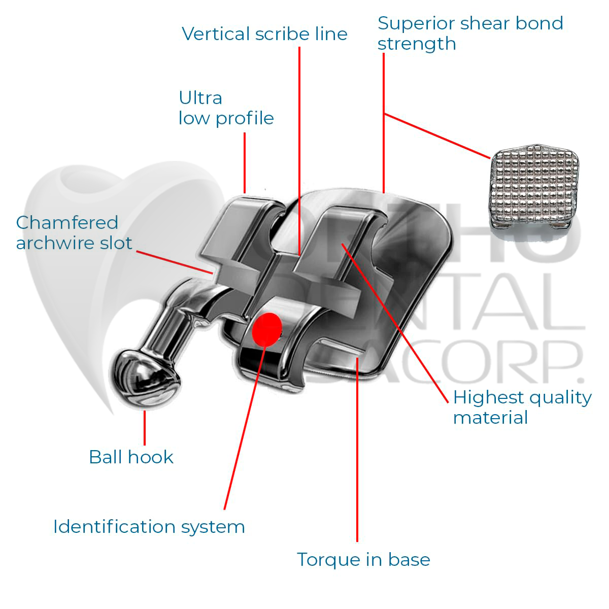 KIT Include Brackets Elastomeric Ligature Ties and bag of Wires Orthodentalusa