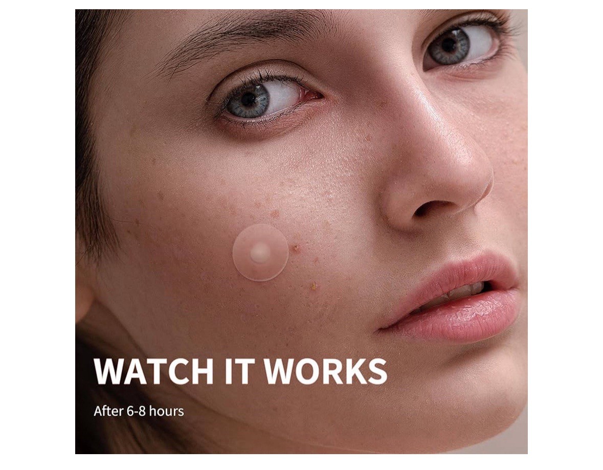 Pimple Patches for Face, 4 Size 300 Counts Acne Patches