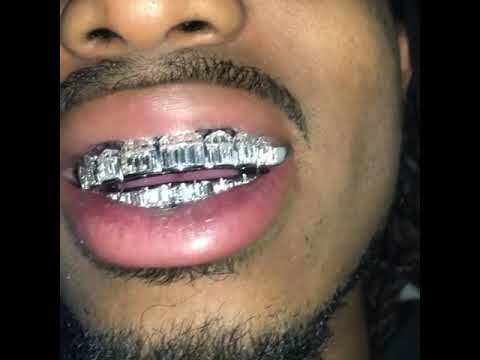 Real 925 Sterling Silver ICED Baguette Rapper GRILLZ Teeth Top & Bottom Set ICY