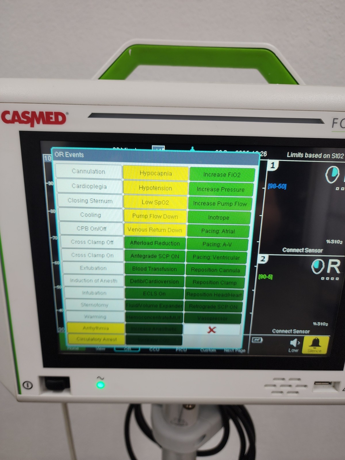 CasMed 01063000 Fore-Sight Elite Absolute Tissue Oximeter with Roller Stand