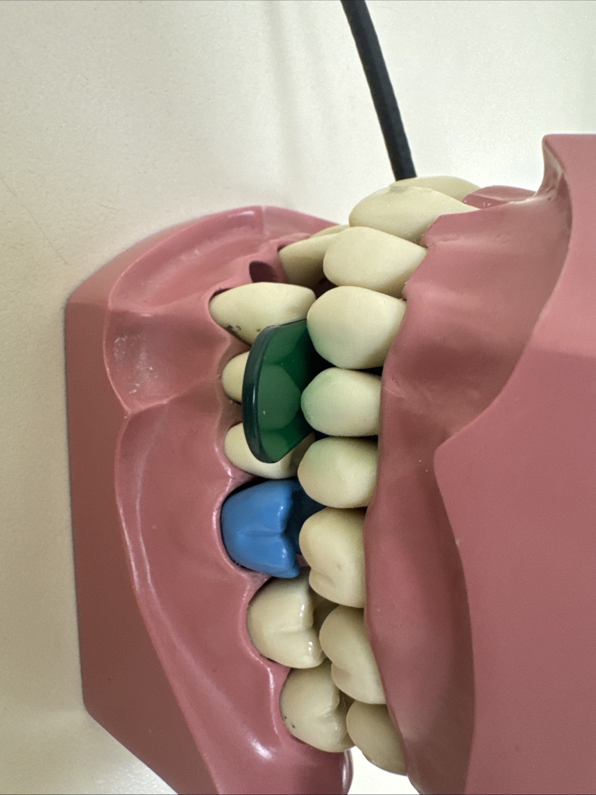 5 pcs Autoclavable - Apical/Bitewing Adult Digital Sensor Positioner-Holder