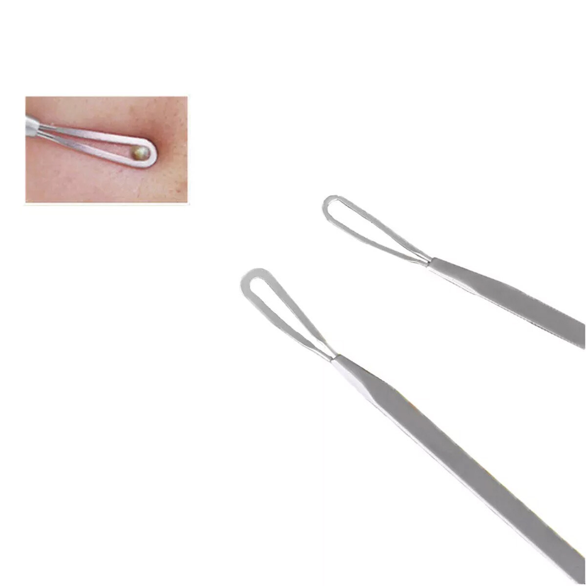 10 Pcs Pimple Popper Blackhead Remover Kit Tools Set Comedone Zit Extractor