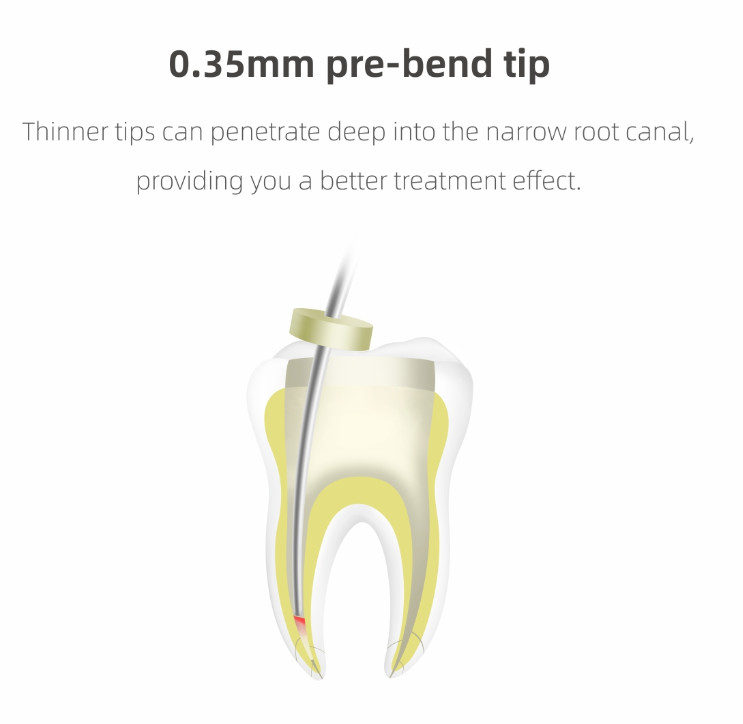 Woodpecker Fi-P Fi-G Fi-E Gutta Percha Cordless Obturation System Heated Pen/Gun