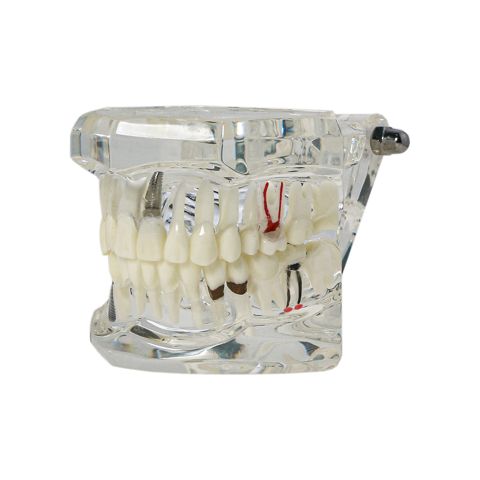 Dental Oral Typodont Model Implant Pathological Teaching Standard Size (Clear)