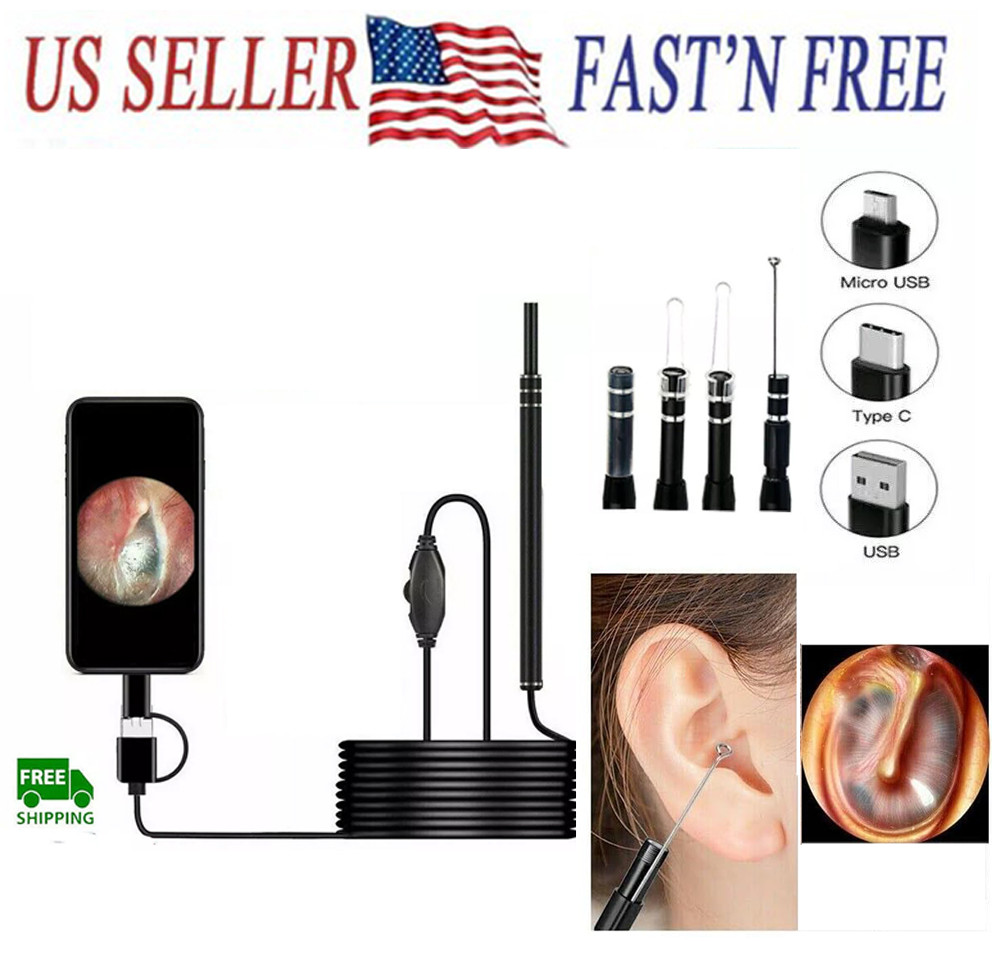 LED Ear Endoscope HD Otoscope Ear Wax Removal Cleaner Tool Camera Kit