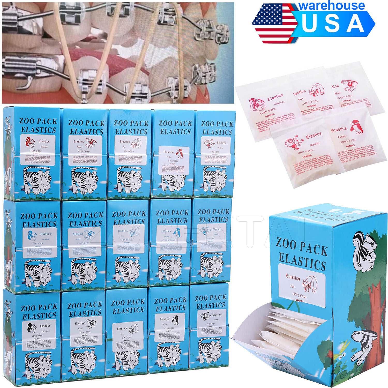 AZDENT Bandas Elásticas Ortodoncia Látex Elásticos Dental  Elastics Rubber Bands