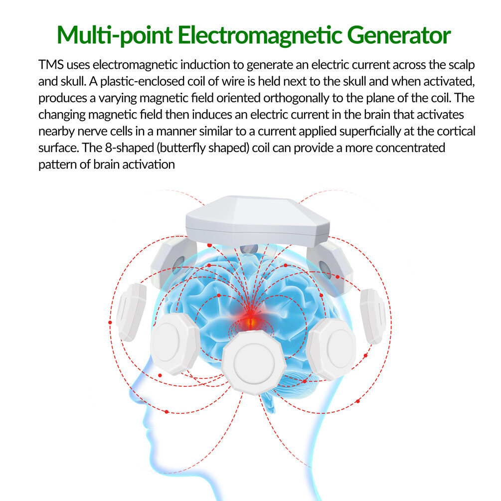 Transcranial Magnetic Stimulator Therapy Parkinsons Insomnia Anxiety Depression