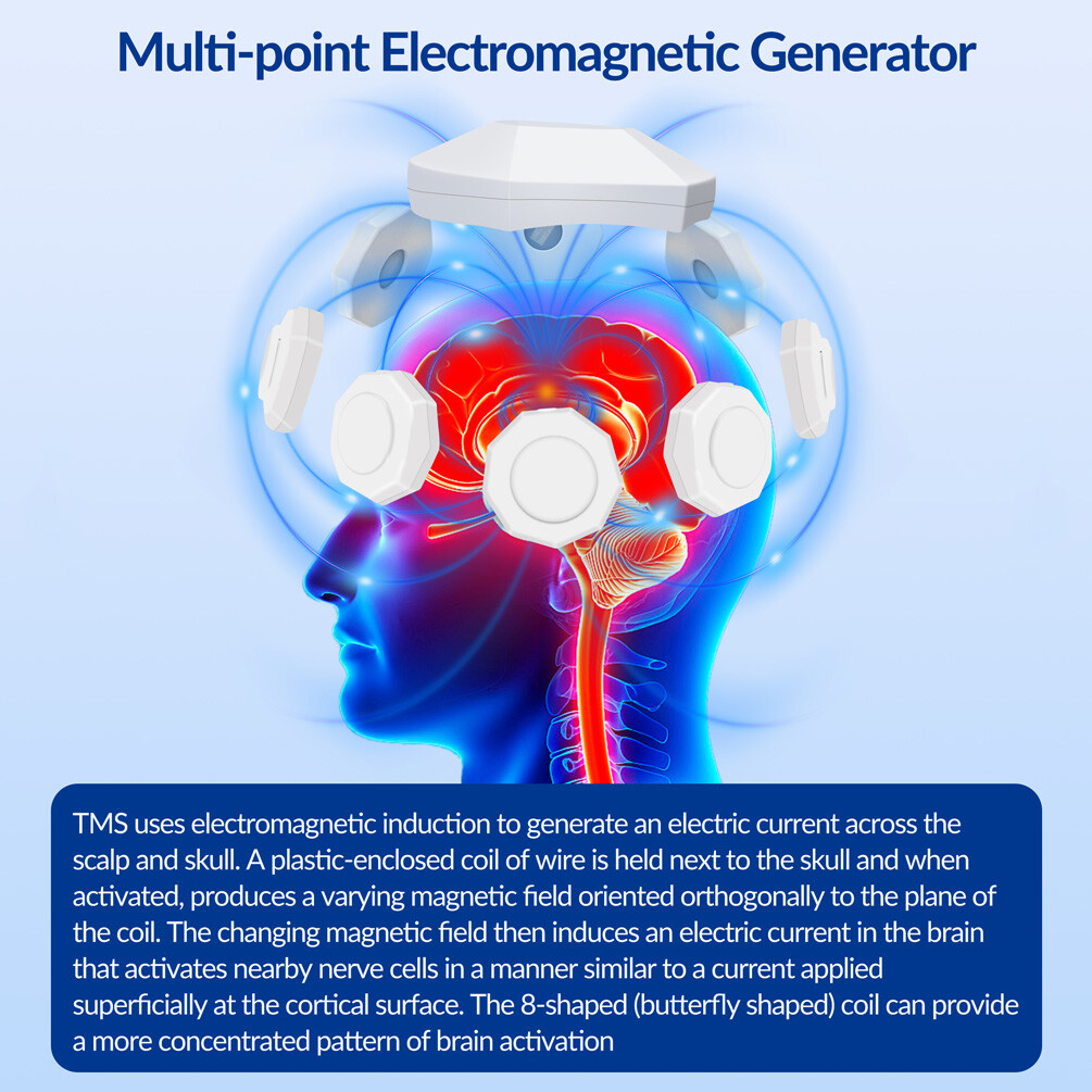 Transcranial Magnetic Stimulation MachineforDepression RTMS Treatment Insomnia O