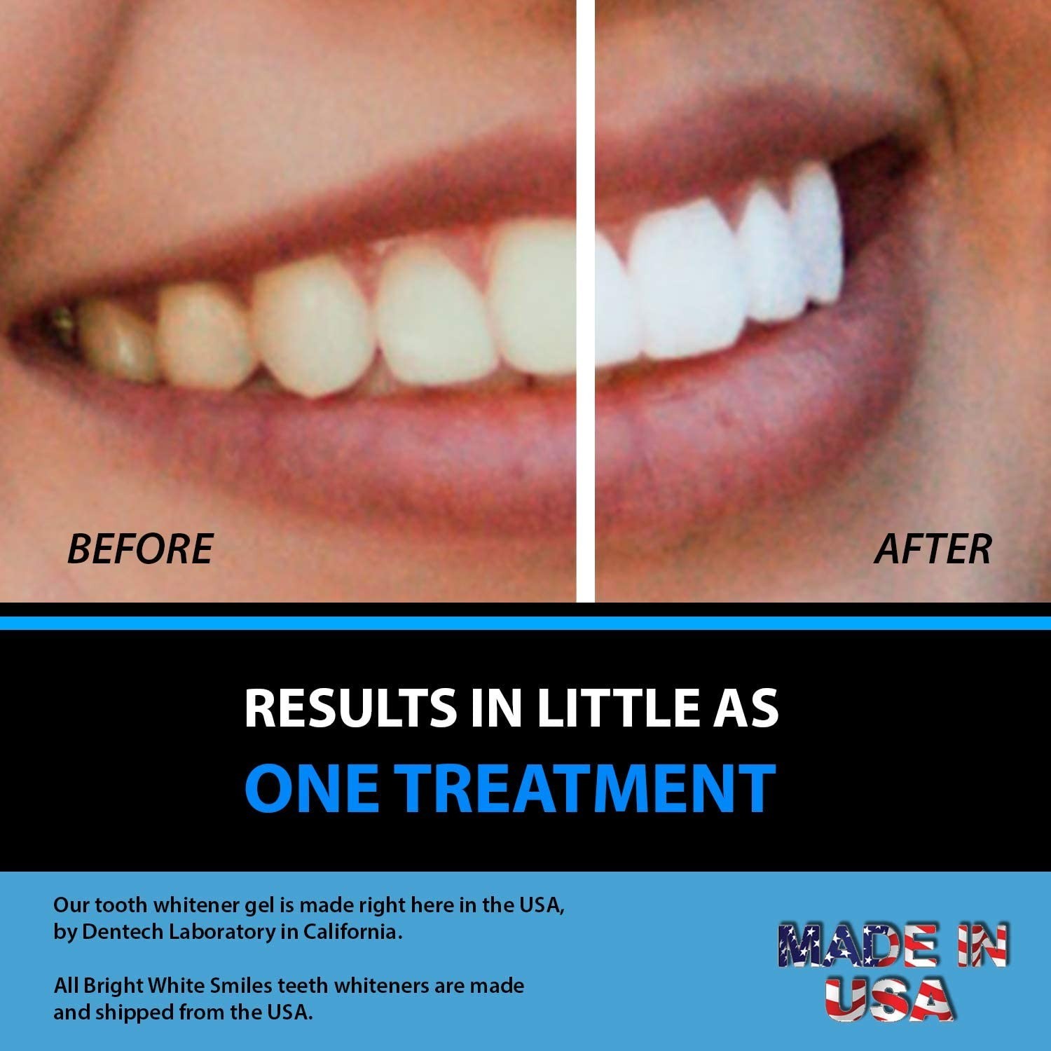 16% HP Teeth Whitener Tooth Whitening Bleach Gel 10 Syringe Professional Kit Lot