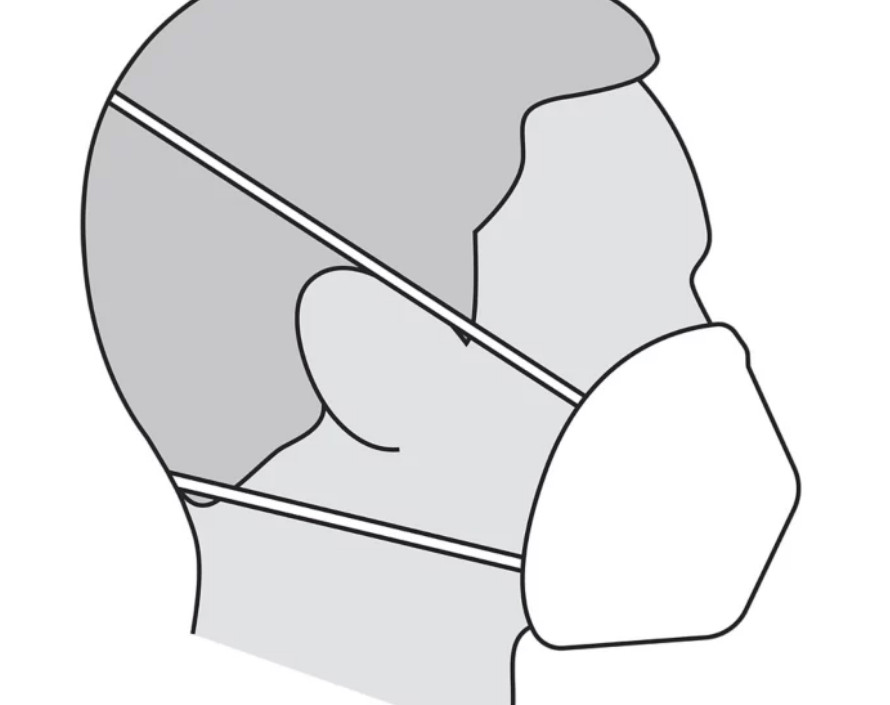 3M N95 Particulate Respirator & Surgical Mask 1860 Series (Box of 20) Exp 3/26