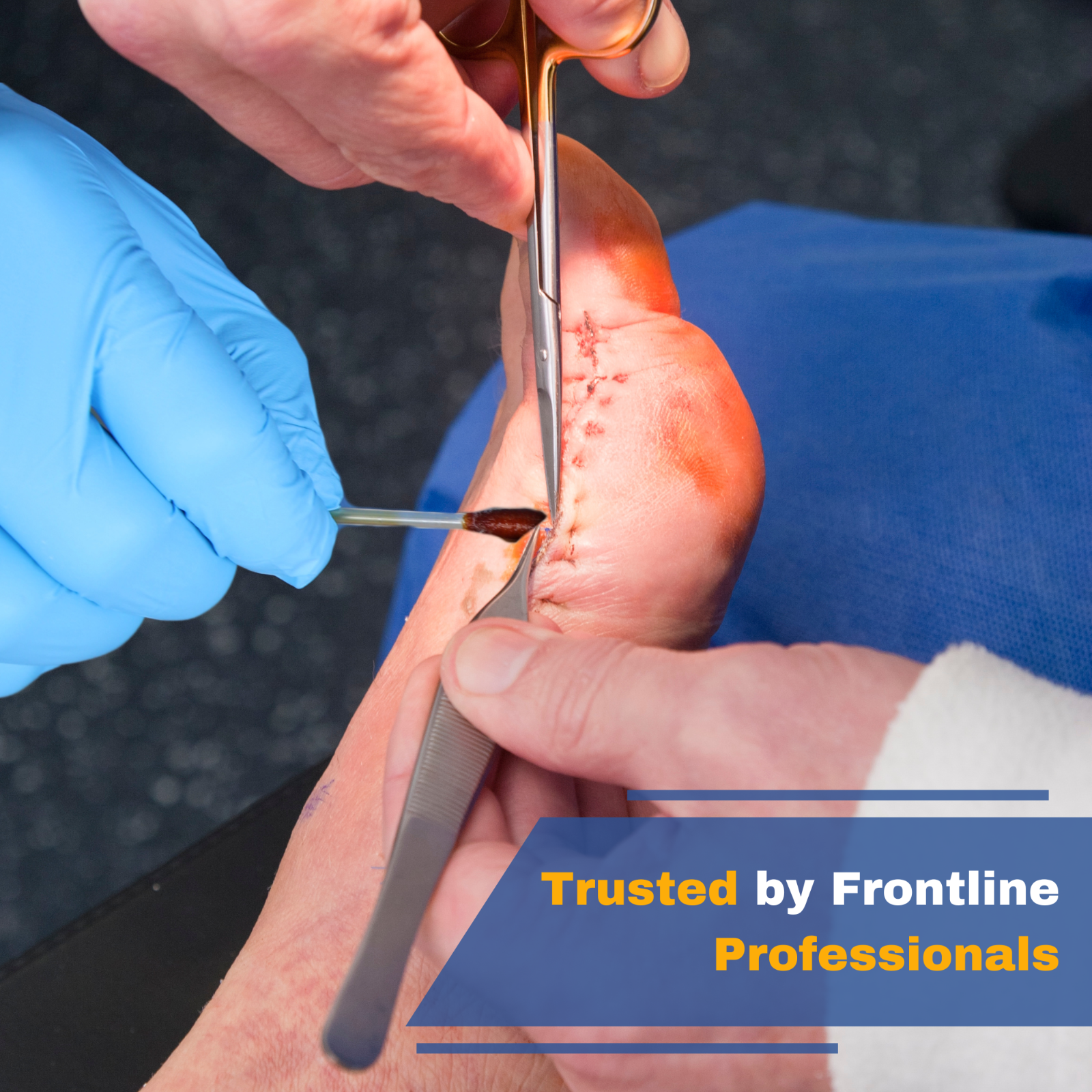 Povidone Iodine Swabs Antiseptic Swabsticks Iodine Solution Wound Cleansing