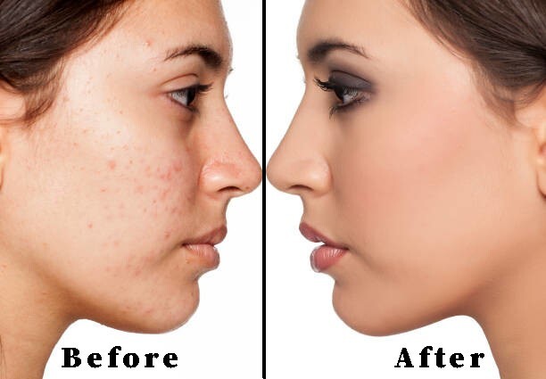 1 lb- 16oz Raw African Black Soap Bar 100% Pure Natural Organic Ghana Bulk BEST!