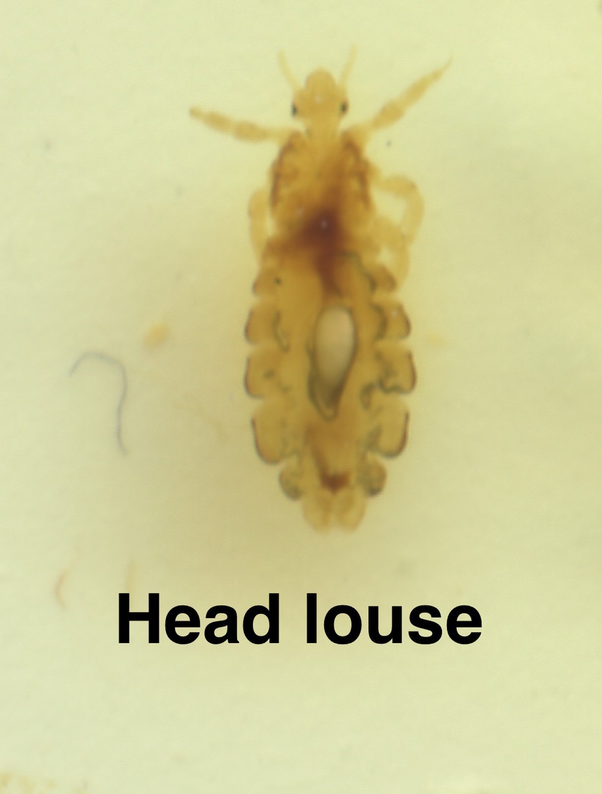 Parasite Microscope Slide Set Deadly Disease Insect Whole Mount Helminth Worm