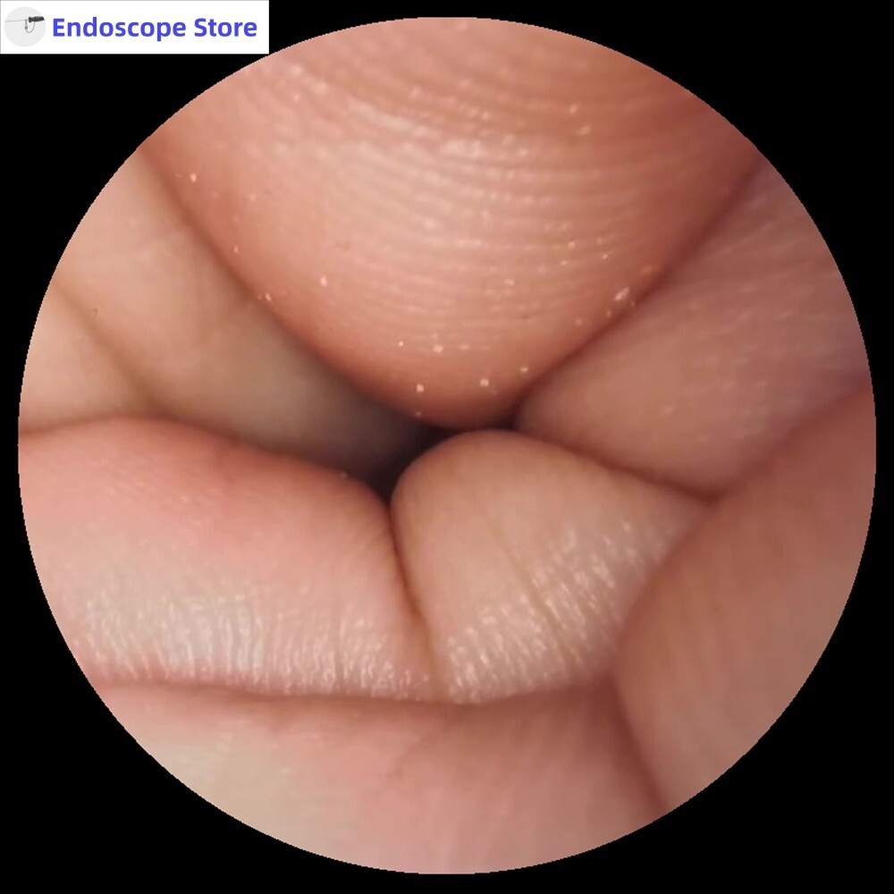 HD 1080P USB Endoscope Camera With LED Light Source ENT Examination Veterinary