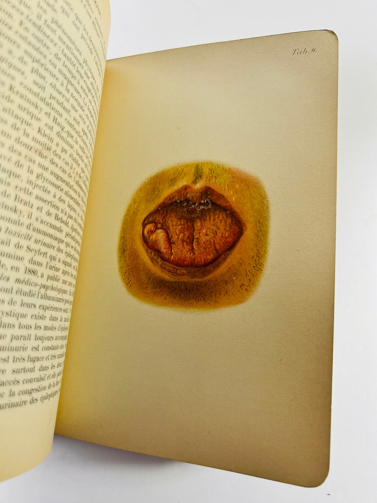 RARE 1904 Manual of Psychiatry ODDITY Medical Book AMAZING weygandt