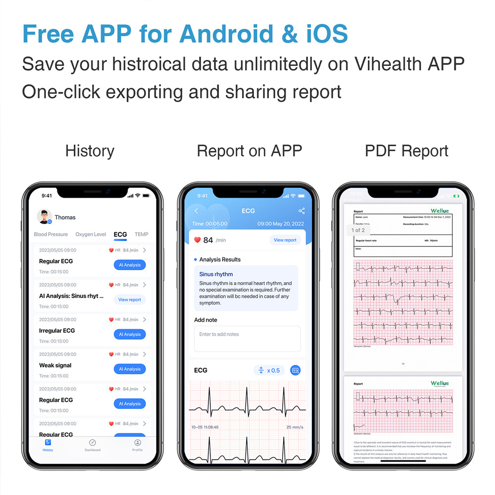 ECG EKG Monitor 30s/60s/5min Recording AI-ECG Analysis Report in App PC Software