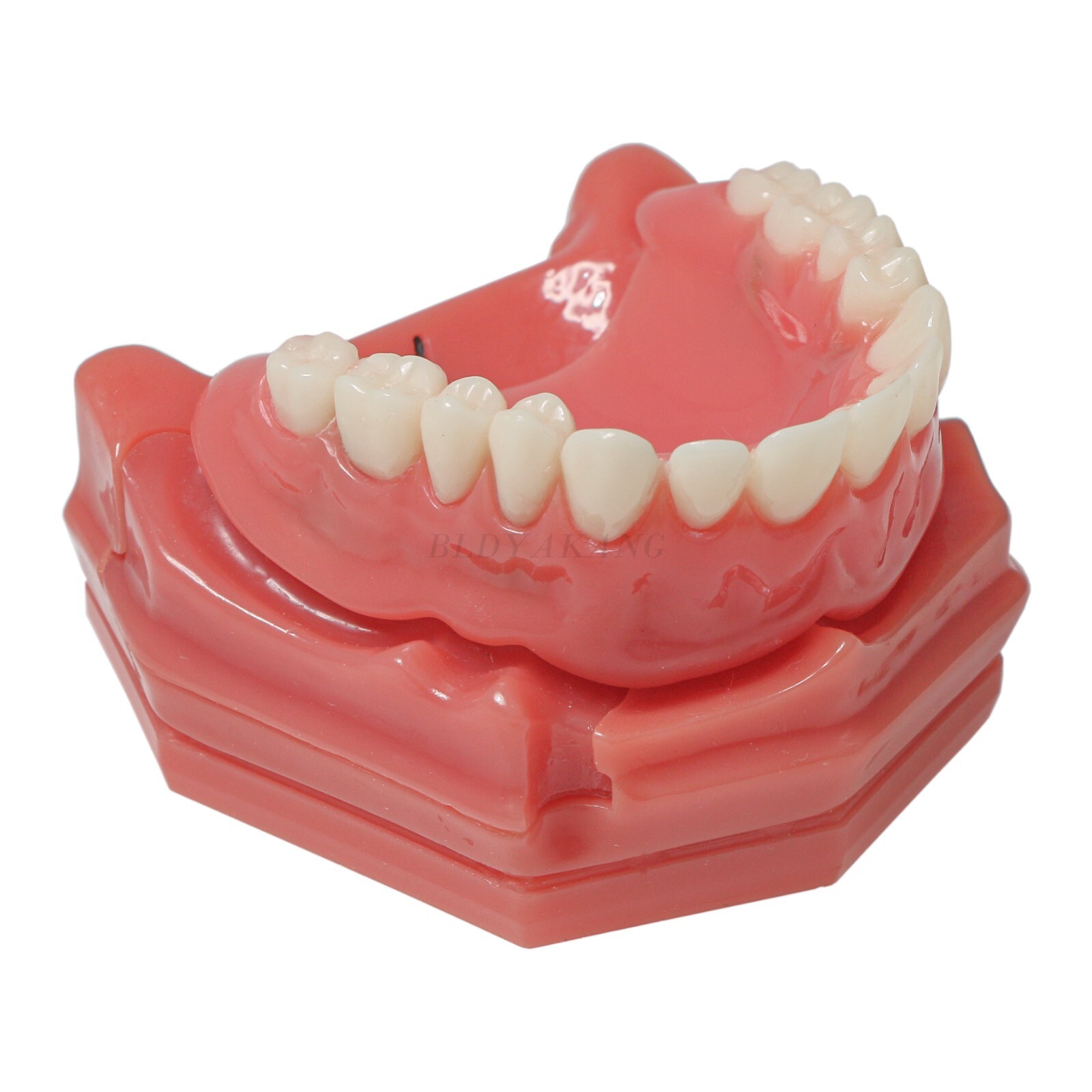 Dental Implant Typodont Teeth Restoration Model Series Overdenture Practice Demo