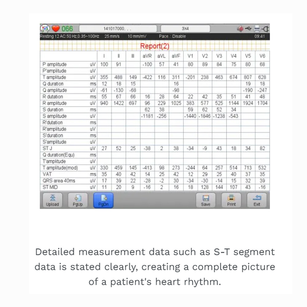 Biocare iE6 12 lead 6 channel ECG Machine Touchscreen with interpretation FDA US