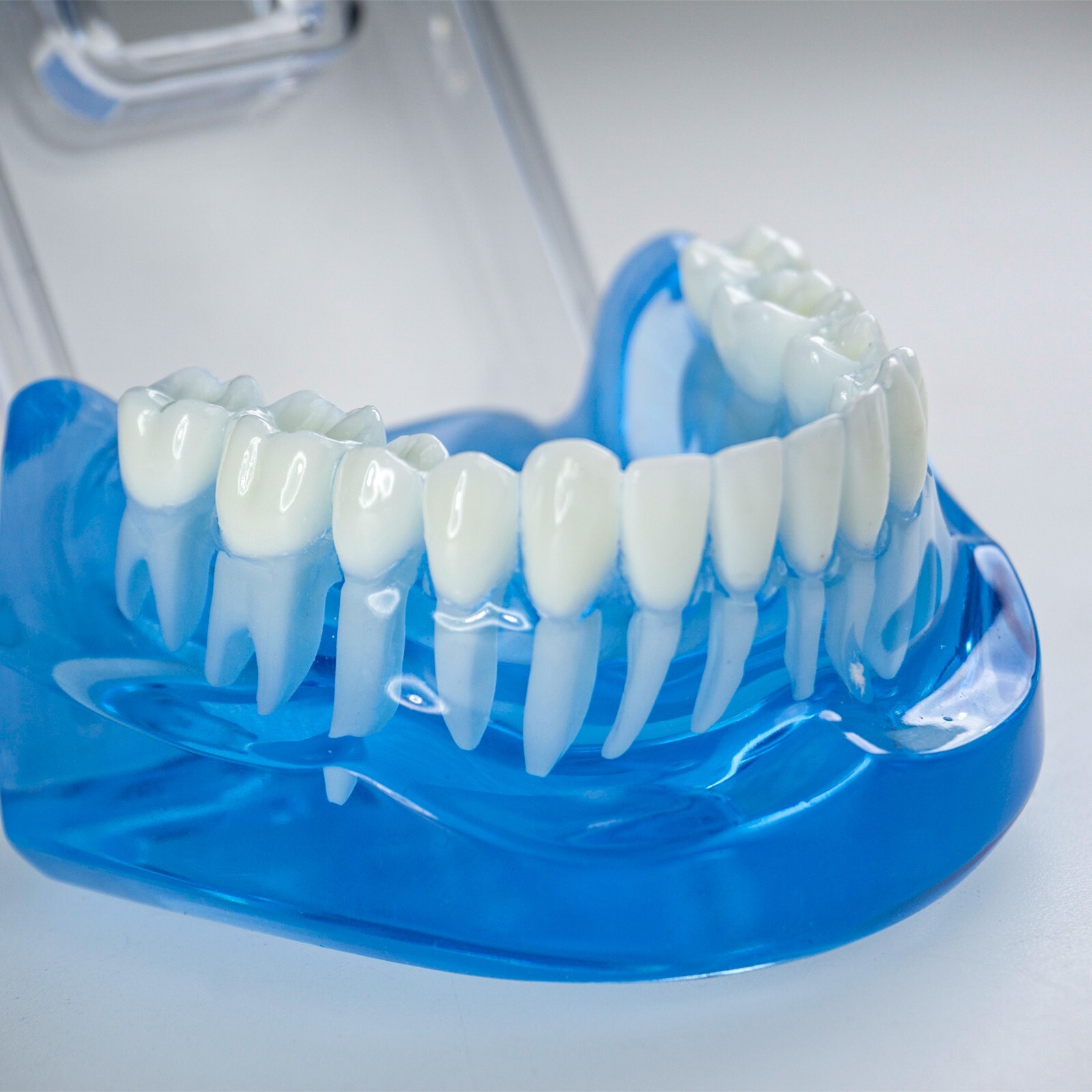 Dental Ortho Teeth Model With Metal Ceramic Brackets Lingual Braces Tube Teach