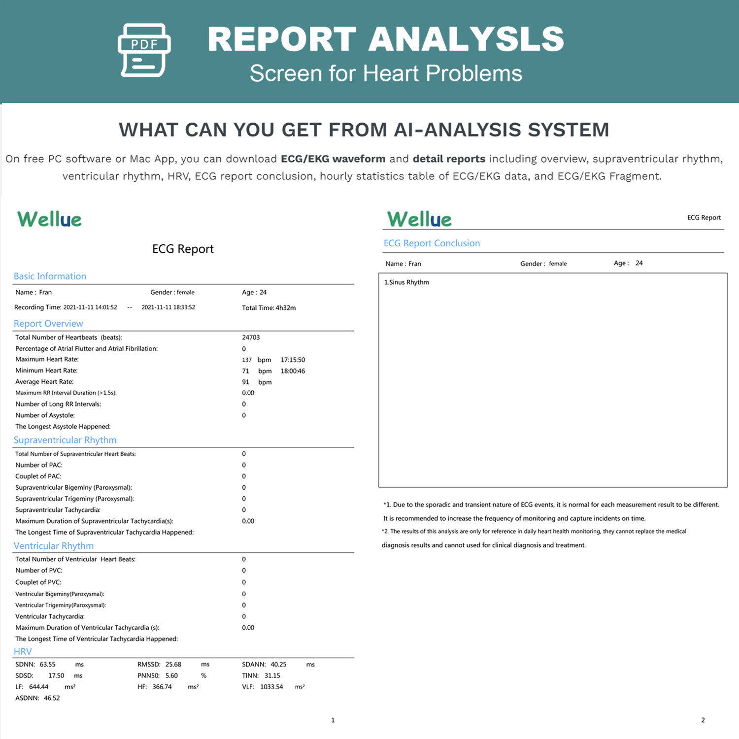 24 hours ECG/EKG Holter Monitor System with AI analysis Detects Afib PC Software
