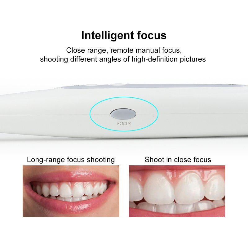 Dental Intraoral Camera USB Digital lmaging Intra Oral HD Camera 4K Mega Pixel