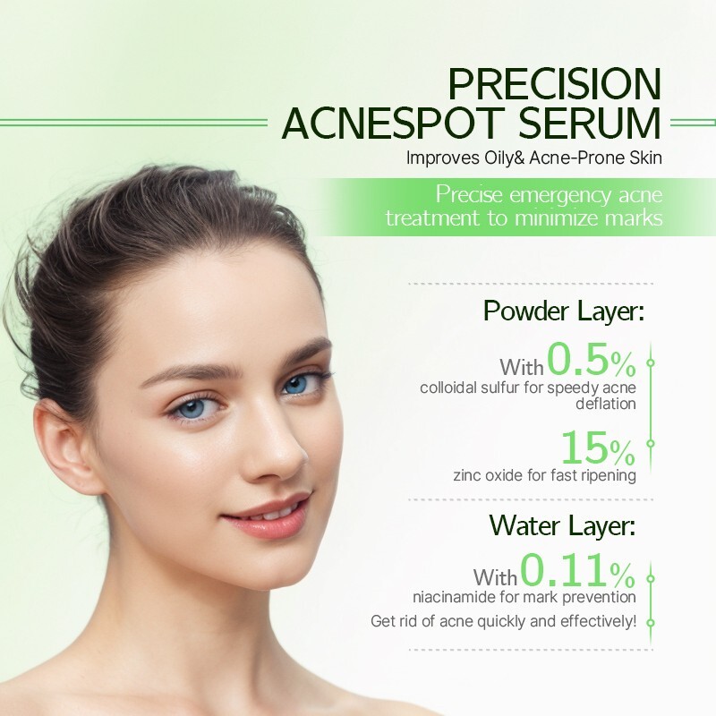 Severe Acne Pimple Treatment Serum Cystic Spot Remover Reduce Redness Swelling