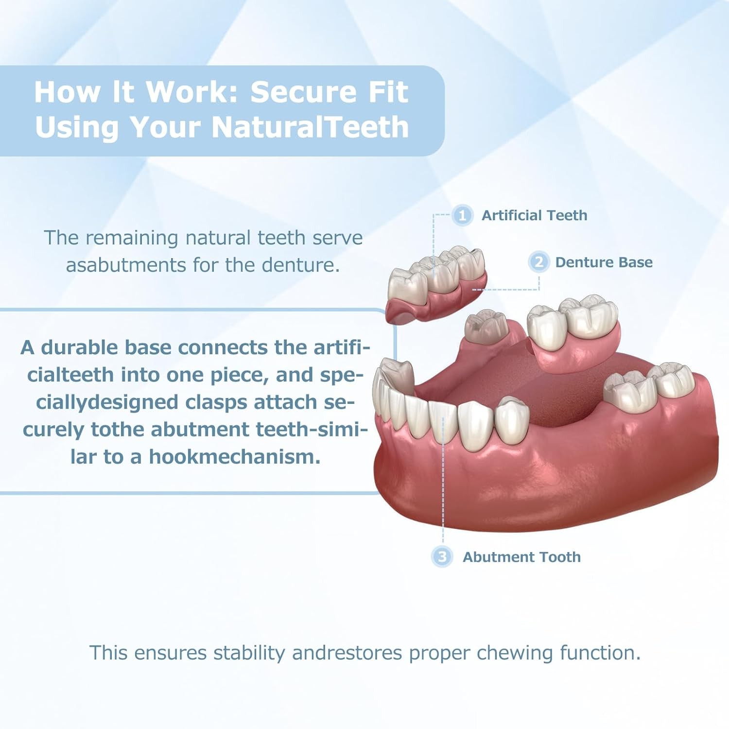 Partial Dentures for Women & Men, Custom Replacement Temporary Flipper Teeth ...