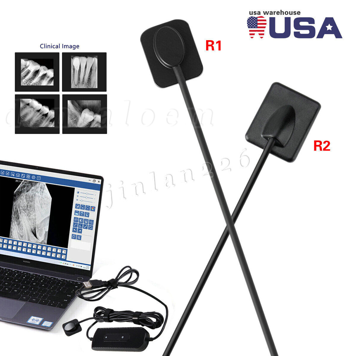 Dental Digital Rayos Ray X Sensor
