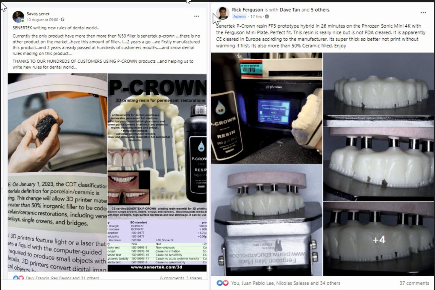 DLP SLA LCD 3d printer permenant crown - teeth resin ..