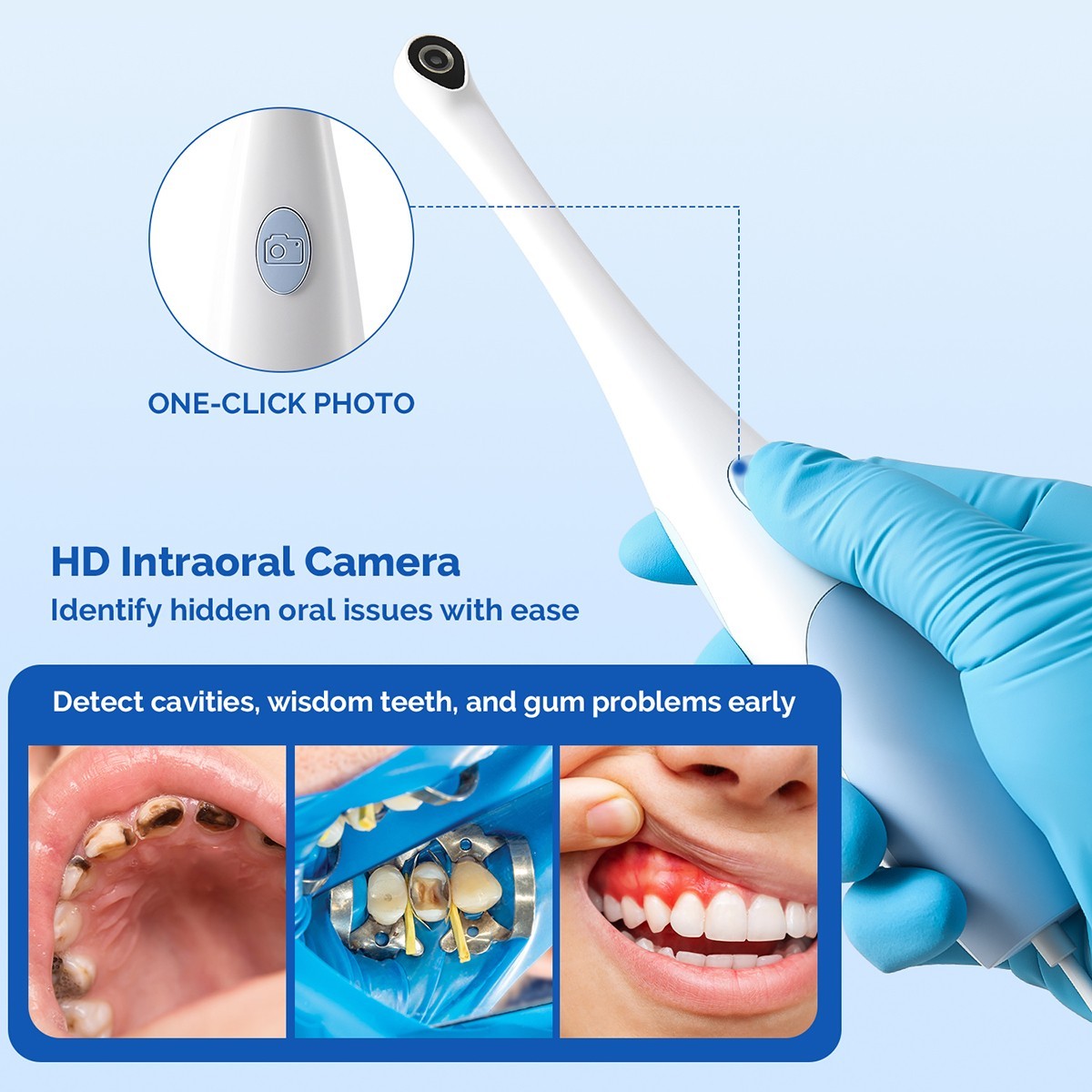 AZDENT Dental Intraoral Camera Digital USB Imaging Focus Intra Oral 8 LED Light