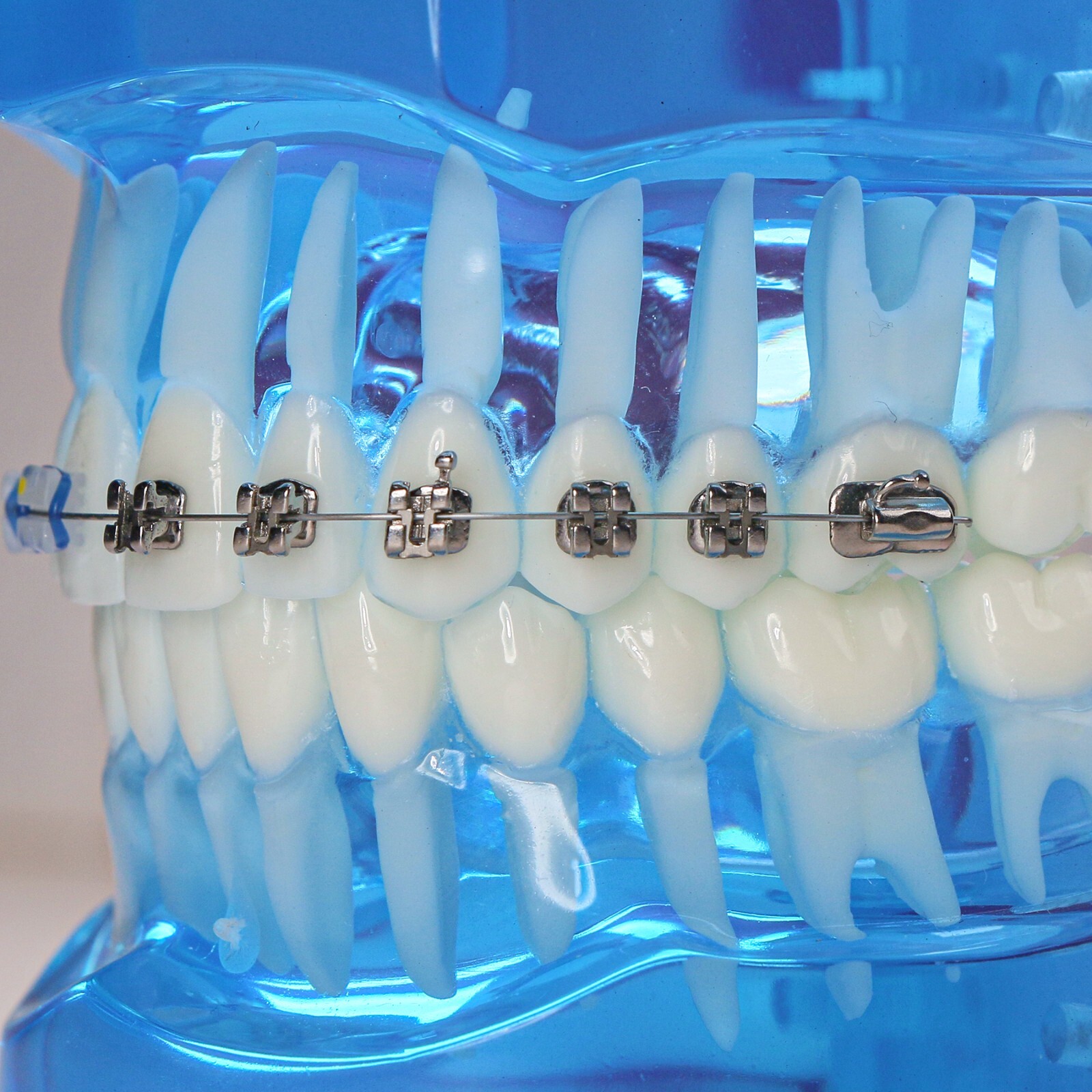 Dental Ortho Teeth Model With Metal Ceramic Brackets Lingual Braces Tube Teach
